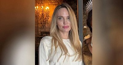 Что случилось с внешностью Анджелины Джоли?